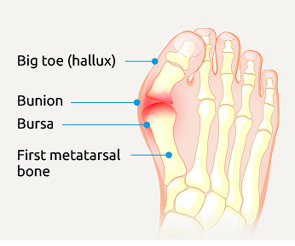 Bone Anatomy Of Big Toe